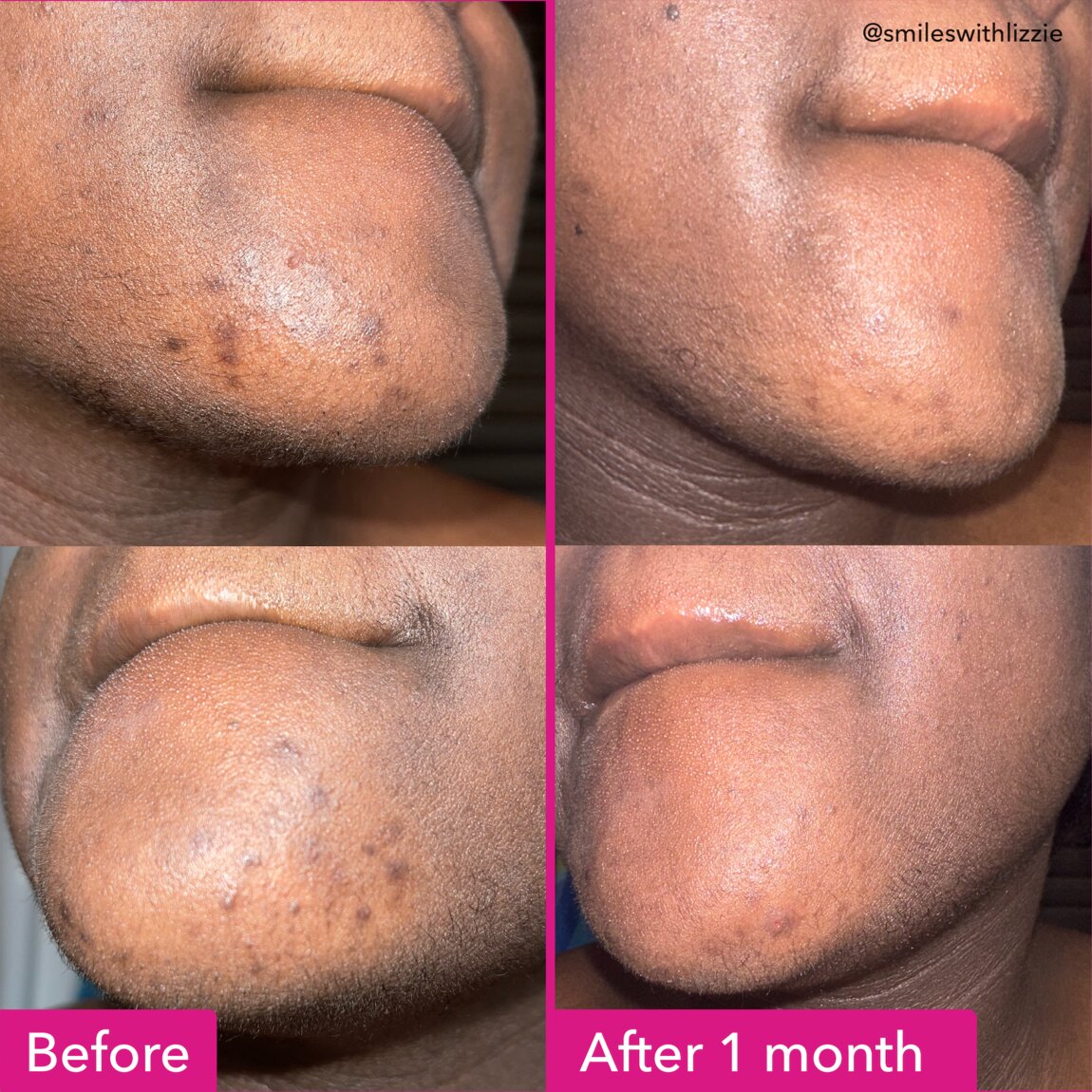 Good Molecules Brightening & Dark Spots Bar
