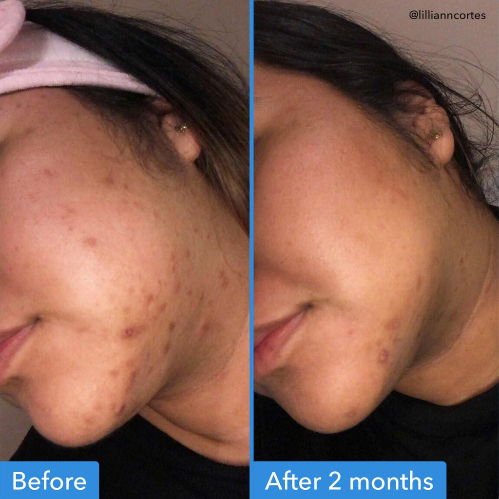 Good Molecules Discoloration Correcting Serum
