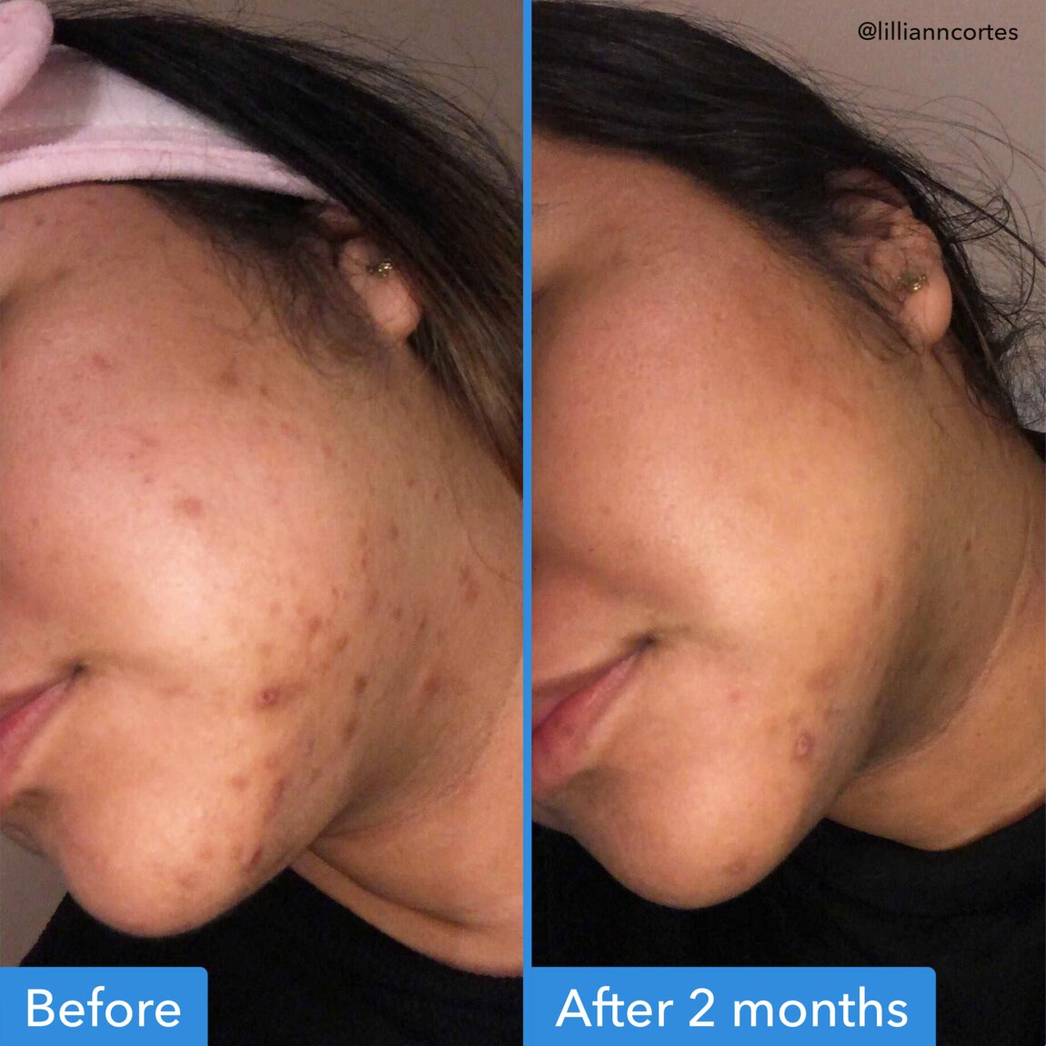 Good Molecules Discoloration Correcting Serum