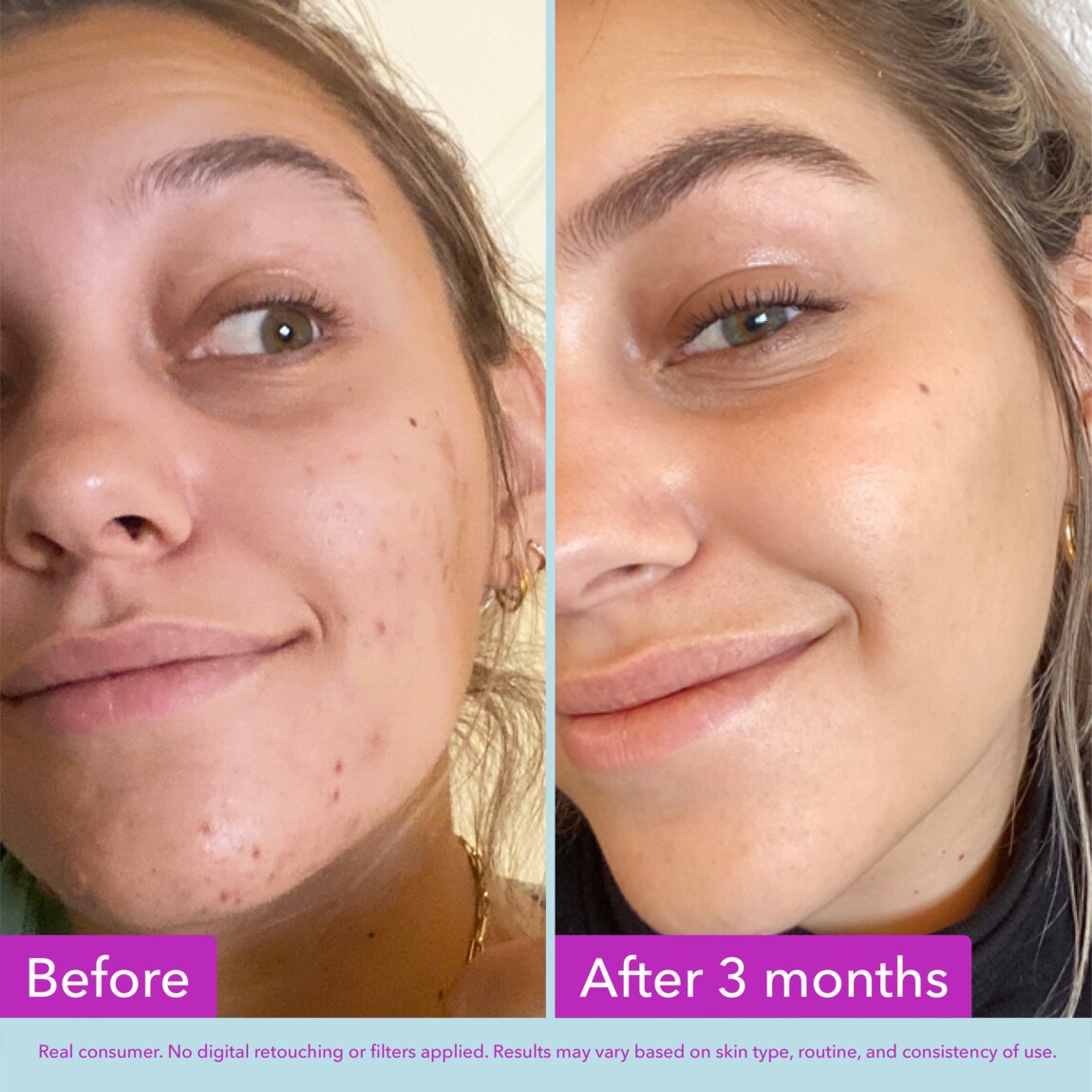Good Molecules Niacinamide Brightening Toner