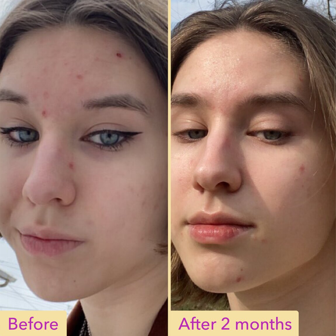 Good Molecules Niacinamide Serum