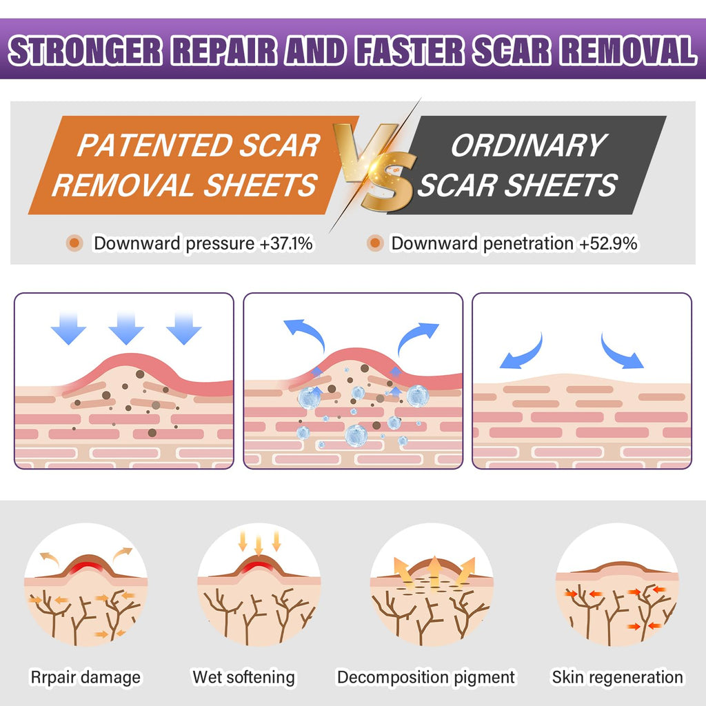 Silicone Scar Sheets