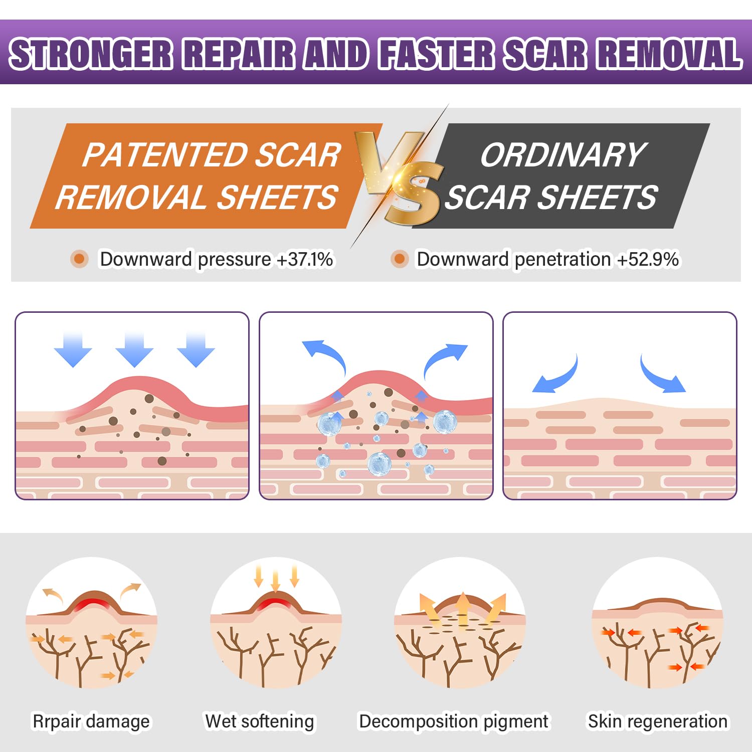 Silicone Scar Sheets