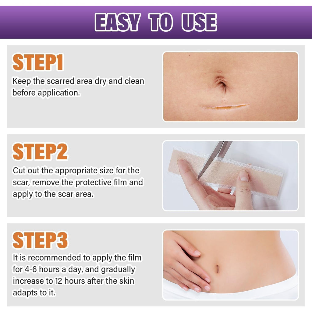 Silicone Scar Sheets